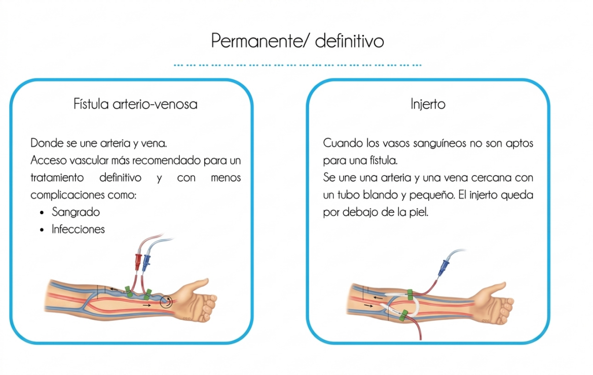Fístula e injerto
